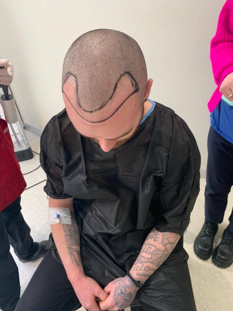 greffe.de_.cheveux.turquiee126cb1e-62be-4faf-b9af-2ed68925ae1b